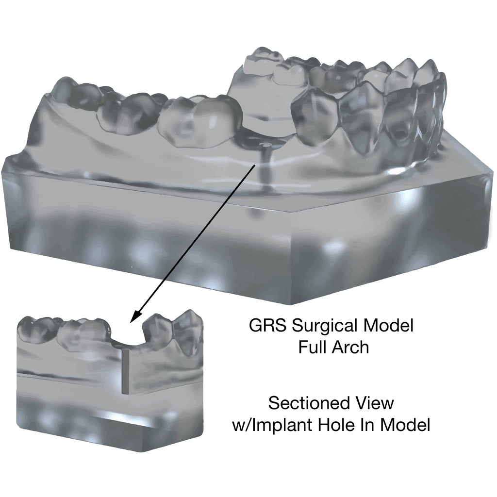 Made-To-Order <br>GRS Surgical Models w/Implant Hole(s)